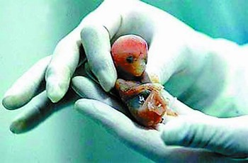 案例